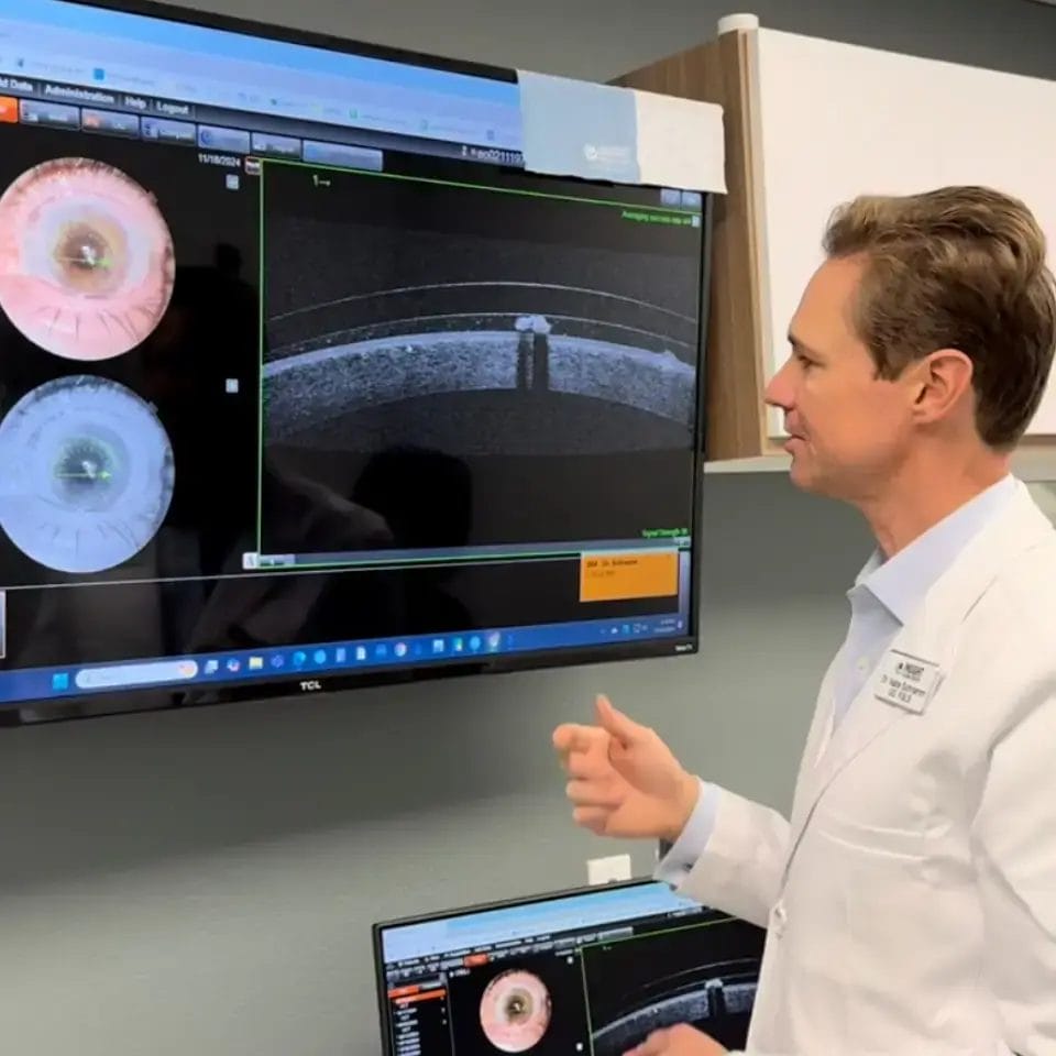 Cornea image